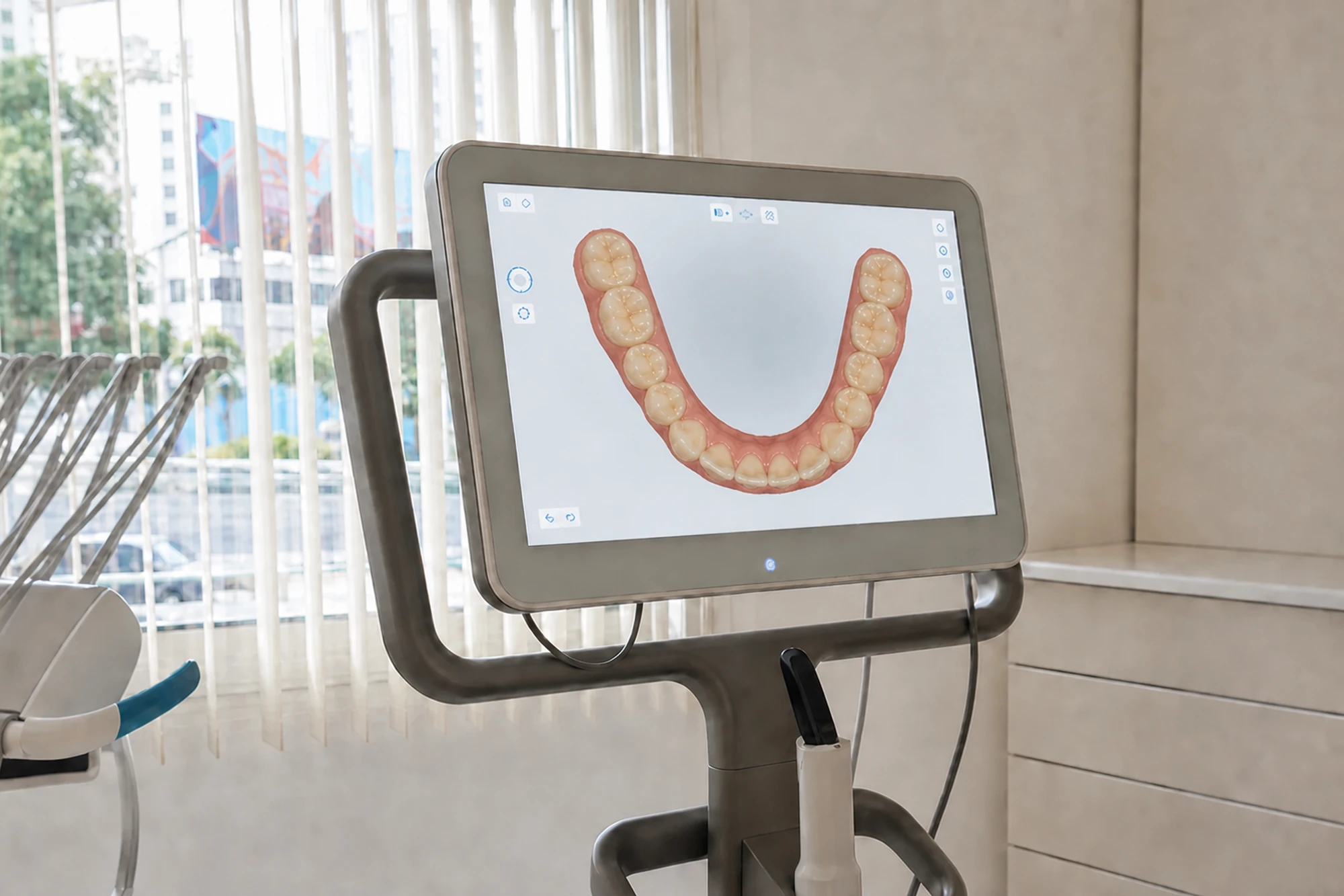 Scanner intraoral affichant une empreinte numérique 3D en couleur