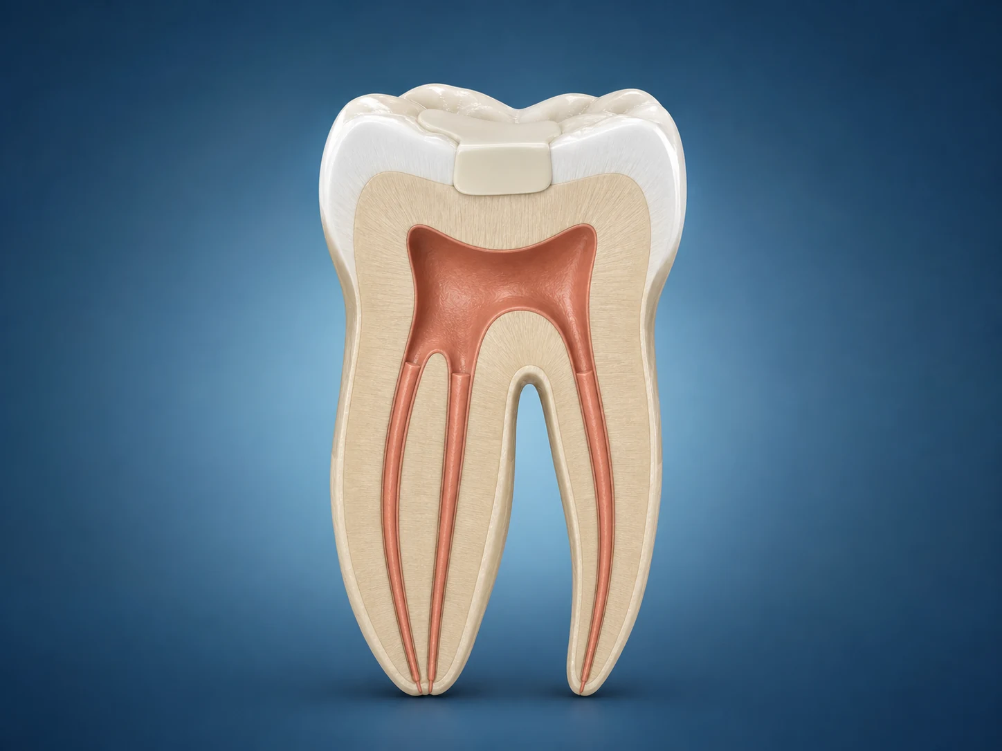 Rendu pédagogique 3D d’un traitement endodontique